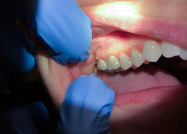 Best Emergency Dental Services for Seniors in West Columbia, TX